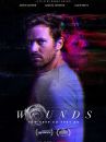 affiche du film Wounds